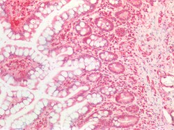 Invitrogen NOTCH1 Polyclonal Antibody 100 μg; Unconjugated:Antibodies,