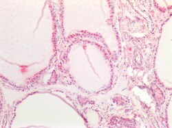 Invitrogen NOTCH1 Polyclonal Antibody 100 μg; Unconjugated:Antibodies,