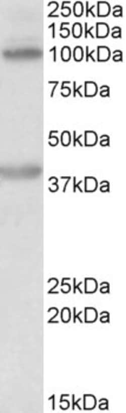 Invitrogen ZEB2 Polyclonal Antibody 100 &mu;g; Unconjugated:Antibodies,