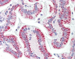 Invitrogen SON Polyclonal Antibody 100 &mu;g | Buy Online | Invitrogen&trade; | Fisher Scientific