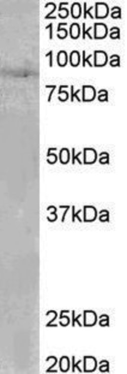 Invitrogen SETDB2 Polyclonal Antibody 100 &mu;g | Buy Online | Invitrogen&trade; | Fisher Scientific