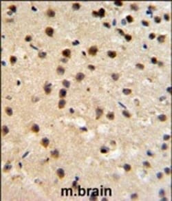 Invitrogen FKBP10 Polyclonal Antibody 400 &mu;L | Buy Online | Invitrogen&trade; | Fisher Scientific