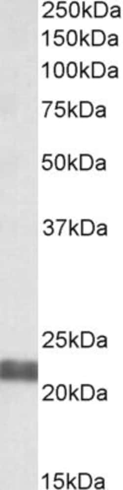 Invitrogen NCE2 Polyclonal Antibody 100 &mu;g; Unconjugated:Antibodies,