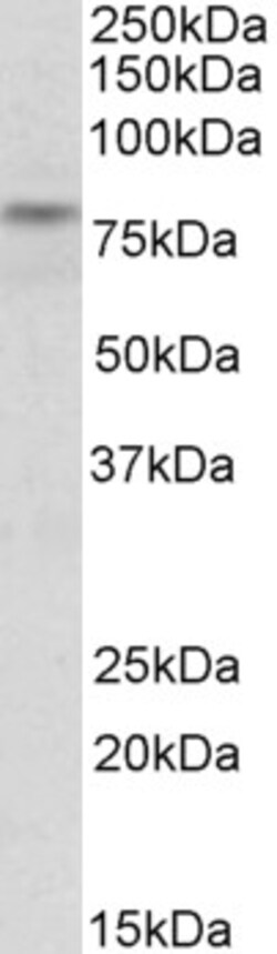 Invitrogen TRIM2 Polyclonal Antibody 100 &mu;g; Unconjugated:Antibodies,