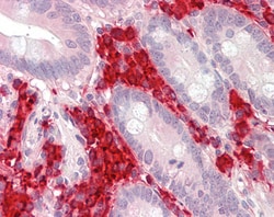 Invitrogen TXNDC5 Polyclonal Antibody 100 &mu;g; Unconjugated:Antibodies,