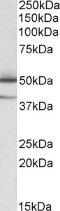 TXNDC5 Polyclonal Antibody, Invitrogen 100 &mu;g; Unconjugated:Antibodies,