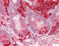 Invitrogen TXNDC5 Polyclonal Antibody 100 &mu;g; Unconjugated:Antibodies,