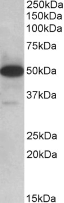 Invitrogen TXNDC5 Polyclonal Antibody 100 &mu;g; Unconjugated:Antibodies,