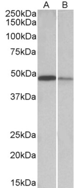 Invitrogen TXNDC5 Polyclonal Antibody 100 &mu;g; Unconjugated:Antibodies,