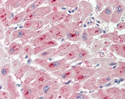 PIM2 Polyclonal Antibody:Antibodies, Polyclonal