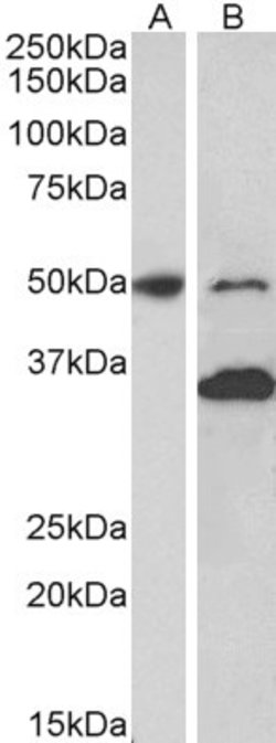 Invitrogen MKRN1 Polyclonal Antibody 100 &mu;g; Unconjugated:Antibodies,