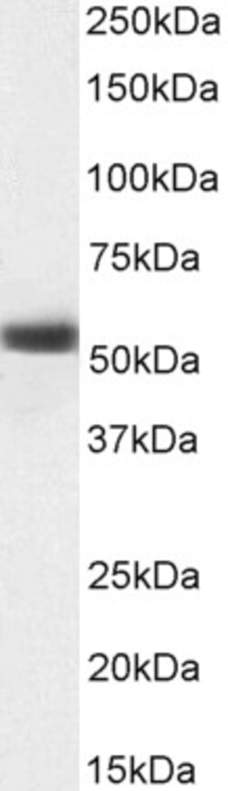 Invitrogen MKRN1 Polyclonal Antibody 100 &mu;g; Unconjugated:Antibodies,