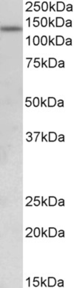 Invitrogen KDM2A Polyclonal Antibody 100 &mu;g; Unconjugated:Antibodies,