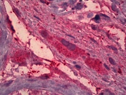 Invitrogen ITIH4 Polyclonal Antibody 100 &mu;g | Buy Online | Invitrogen&trade; | Fisher Scientific