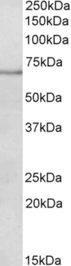 Invitrogen PAPD5 Polyclonal Antibody 100 μg; Unconjugated:Antibodies,