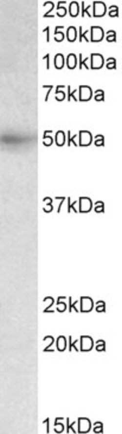 Invitrogen SLC46A1 Polyclonal Antibody 100 &mu;g; Unconjugated:Antibodies,