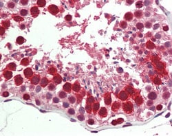Invitrogen RTCB Polyclonal Antibody 100 μg; Unconjugated:Antibodies,