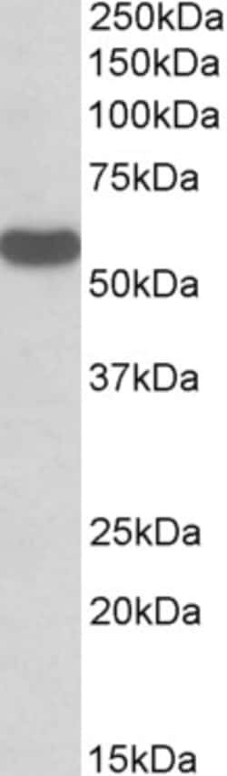 Invitrogen RTCB Polyclonal Antibody 100 μg; Unconjugated:Antibodies,