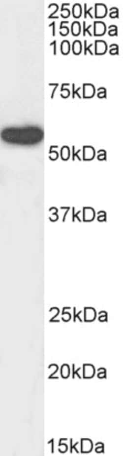 Invitrogen RTCB Polyclonal Antibody, Biotin 100 &mu;g; Biotin:Antibodies,