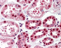 Invitrogen RTCB Polyclonal Antibody 100 &mu;g; Unconjugated:Antibodies,