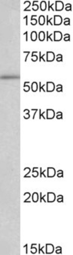 Invitrogen RTCB Polyclonal Antibody 100 &mu;g; Unconjugated:Antibodies,