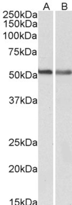 Invitrogen Cannabinoid Receptor 1 Polyclonal Antibody 100 &mu;g; Unconjugated:Antibodies,