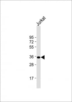 Invitrogen FBP1 Polyclonal Antibody 400 &mu;L; Unconjugated:Antibodies,