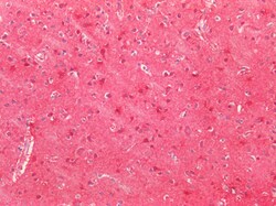 Invitrogen SOD2 (MnSOD) Polyclonal Antibody 100 &mu;g; Unconjugated:Antibodies,