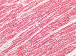 Invitrogen SOD2 (MnSOD) Polyclonal Antibody 100 &mu;g; Unconjugated:Antibodies,