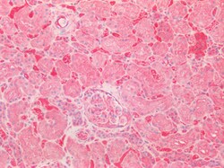 Invitrogen SOD2 (MnSOD) Polyclonal Antibody 100 &mu;g; Unconjugated:Antibodies,
