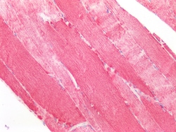 Invitrogen SOD2 (MnSOD) Polyclonal Antibody 100 &mu;g; Unconjugated:Antibodies,