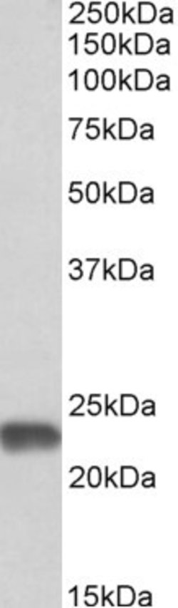 Invitrogen SOD2 (MnSOD) Polyclonal Antibody 100 &mu;g; Unconjugated:Antibodies,