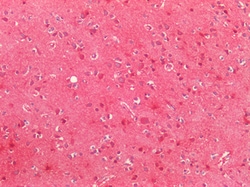 Invitrogen SOD2 (MnSOD) Polyclonal Antibody 100 &mu;g; Unconjugated:Antibodies,
