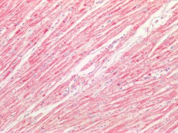 Invitrogen SOD2 (MnSOD) Polyclonal Antibody 100 &mu;g; Unconjugated:Antibodies,