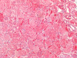 Invitrogen SOD2 (MnSOD) Polyclonal Antibody 100 &mu;g; Unconjugated:Antibodies,