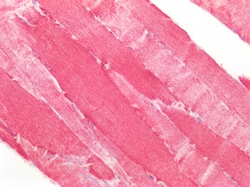 Invitrogen SOD2 (MnSOD) Polyclonal Antibody 100 &mu;g; Unconjugated:Antibodies,