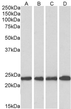 Invitrogen SOD2 (MnSOD) Polyclonal Antibody 100 &mu;g; Unconjugated:Antibodies,
