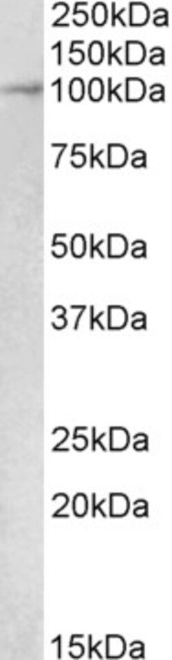 Invitrogen MALT1 Polyclonal Antibody 100 &mu;g; Unconjugated:Antibodies,