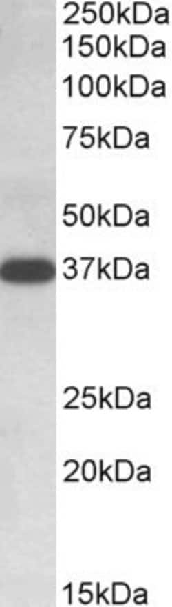 Invitrogen IDH3A Polyclonal Antibody 100 &mu;g; Unconjugated:Antibodies,