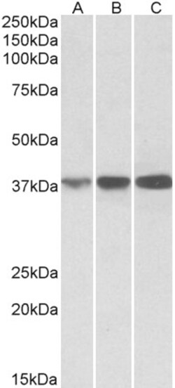 Invitrogen IDH3A Polyclonal Antibody 100 &mu;g; Unconjugated:Antibodies,