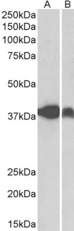Invitrogen IDH3A Polyclonal Antibody 100 &mu;g; Unconjugated:Antibodies,