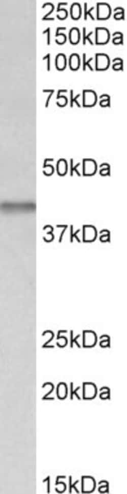 Invitrogen IDH3B Polyclonal Antibody 100 μg; Unconjugated:Antibodies,
