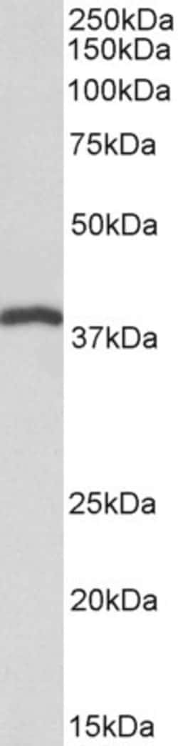 Invitrogen IDH3B Polyclonal Antibody 100 μg; Unconjugated:Antibodies,