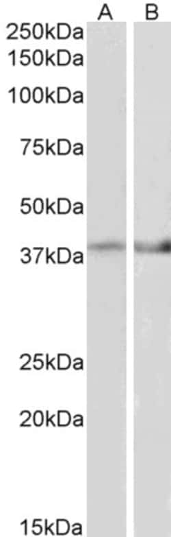 Invitrogen IDH3B Polyclonal Antibody 100 μg; Unconjugated:Antibodies,