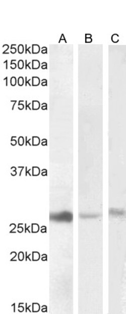 Invitrogen DNAJB9 Polyclonal Antibody 100 &mu;g | Buy Online | Invitrogen&trade; | Fisher Scientific