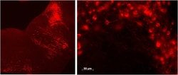 Invitrogen TPH2 Polyclonal Antibody 100 &mu;g; Unconjugated:Antibodies,