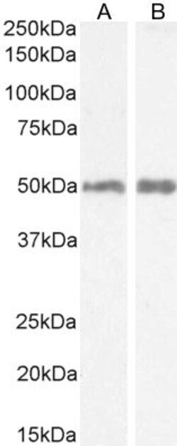 Invitrogen HRH2 Polyclonal Antibody 100 &mu;g; Unconjugated:Antibodies,