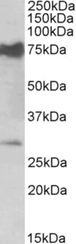 NMNAT3 Polyclonal Antibody, Invitrogen 100 &mu;g; Unconjugated:Antibodies,