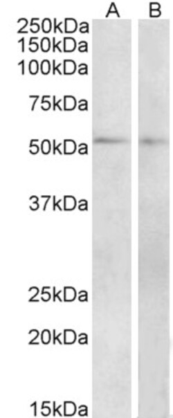 Invitrogen VIPR1 Polyclonal Antibody 100 μg; Unconjugated:Antibodies,