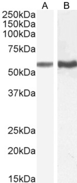 Invitrogen TGFBR1 Polyclonal Antibody 100 &mu;g; Unconjugated:Antibodies,